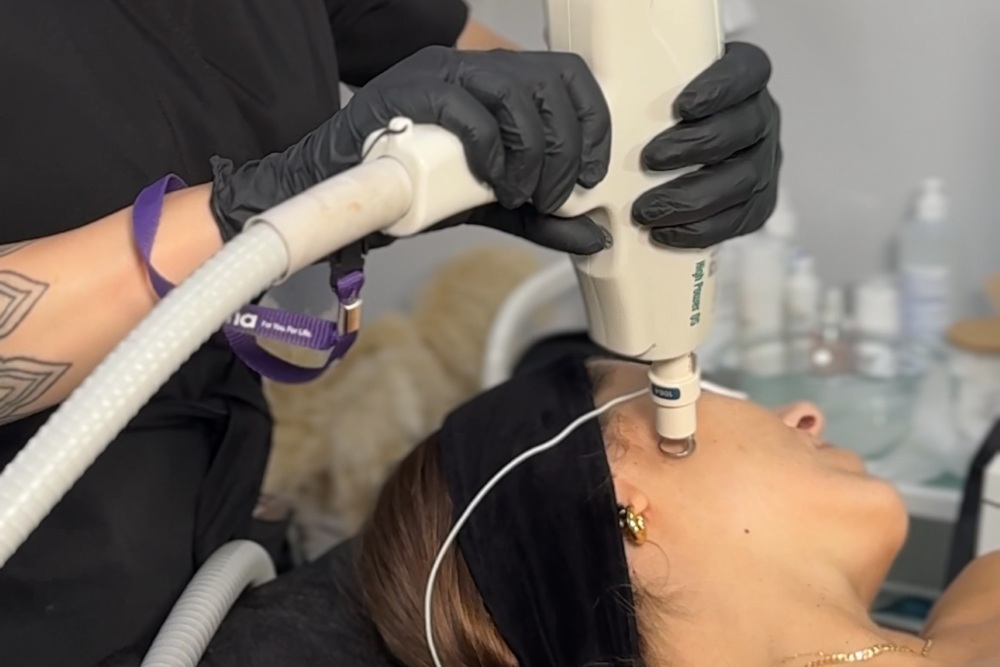 Pielęgnacja twarzy 3 laser