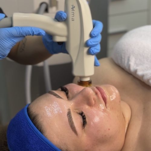 Pracownia Figury Alma Accent Prime Pracownia Figury Alma Accent Prime