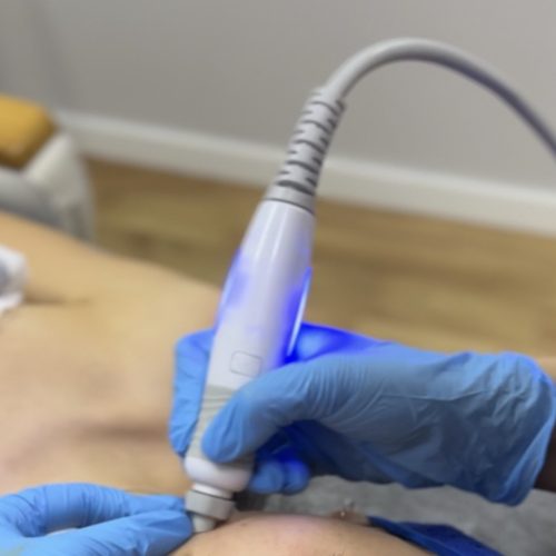 Zabiegi estetyczne dla mężczyzn Legionowo Pracownia Figury Oczyszczanie Wodorowe