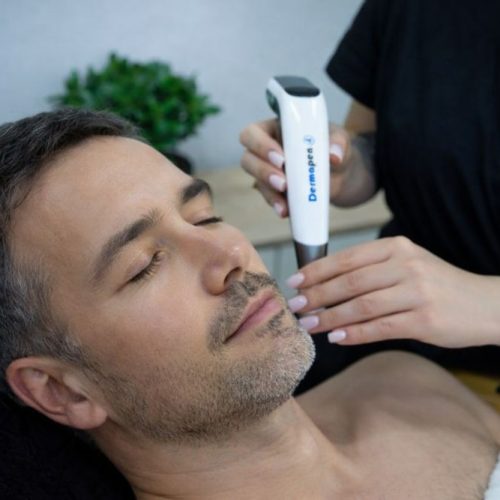 dermapen dla mężczyzn dermapen dla mężczyzn