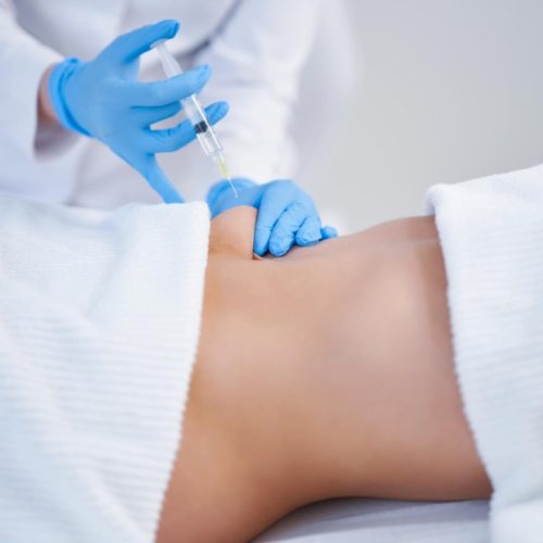 lipoliza iniekcyjna lipoliza iniekcyjna